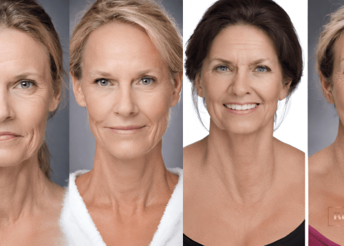 Real Results: Botox Before and After Images & Stories