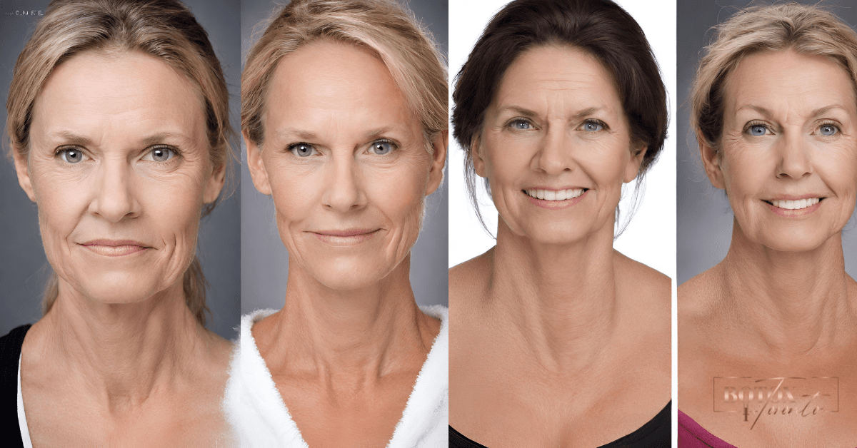 Real Results: Botox Before and After Images & Stories
